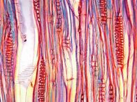Tangential section